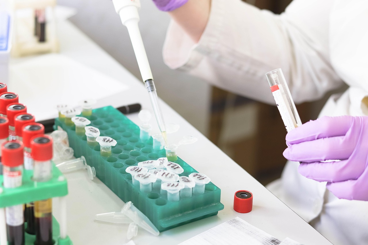 Laboratory, medical, medicine, hand, research, lab, test, doctor, equipment, scientist, woman, chemistry, science, hospital, experiment, person, technician, technology, healthcare, working, health, tu